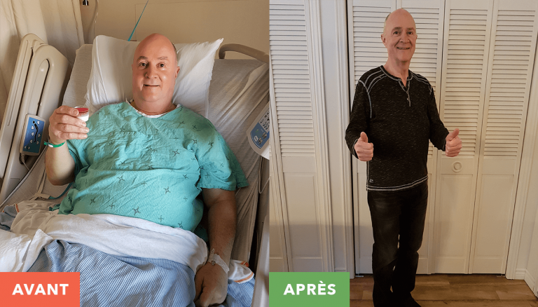 Laurier Quesnel avant et apres