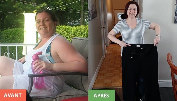 Kim Mongrain avant et apres