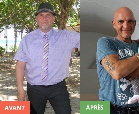 Marc Gauthier avant et apres