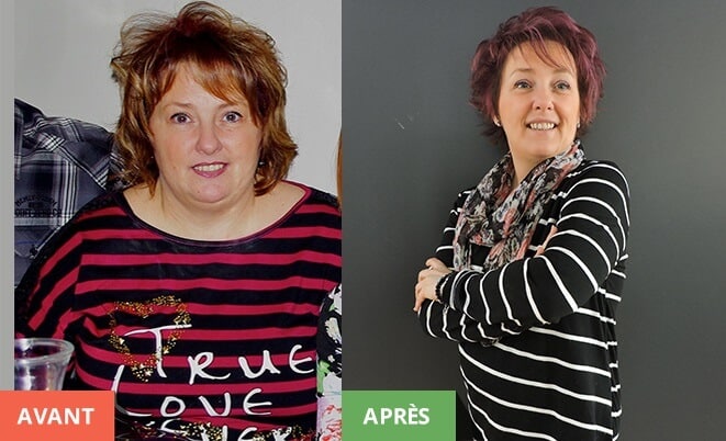 Nancy Falardeau avant et apres