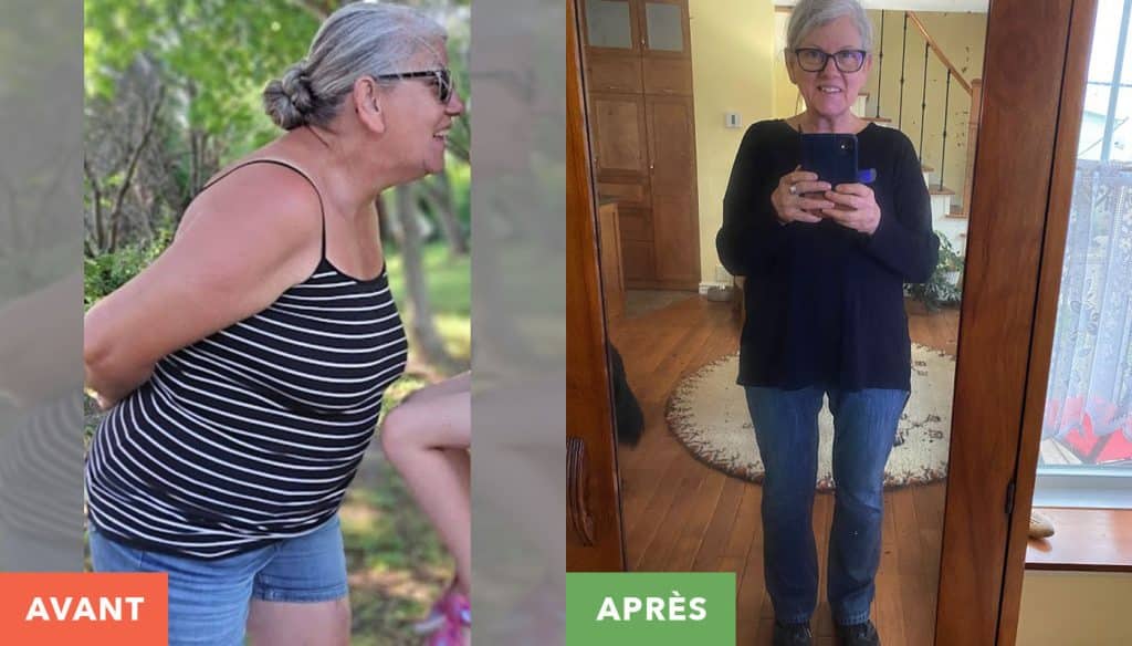 Suzie Tremblay avant et apres